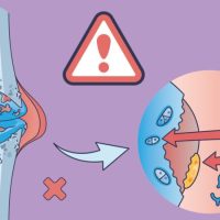 „Osteoporoza – cichy złodziej kości – jak nie&nbsp;dać się okraść?”